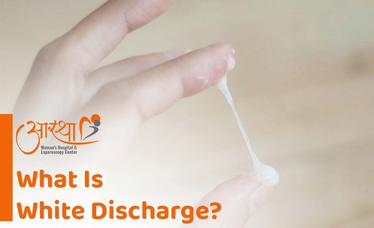 What Is White Discharge 